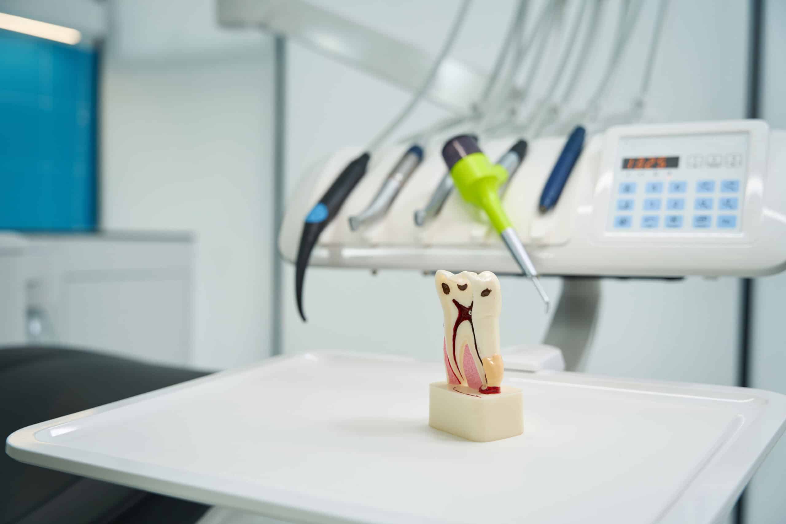 City Clinic – Root Canals