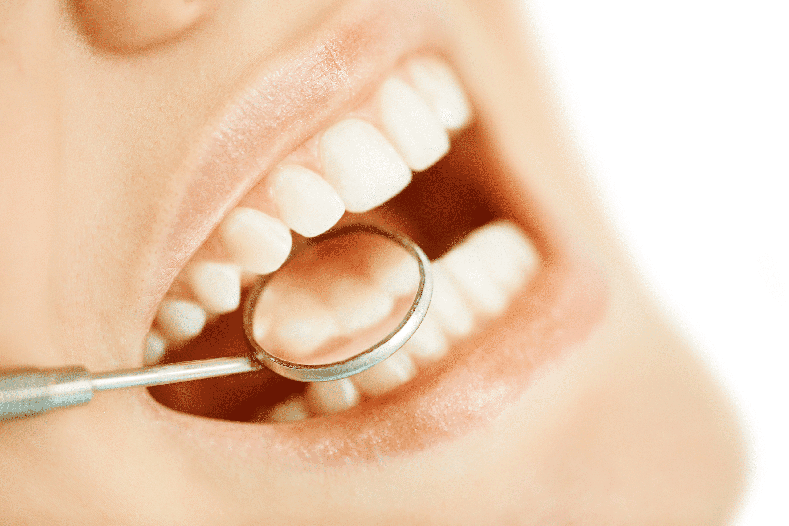 City Clinic – oral hygiene