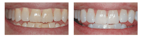 City Clinic – teeth